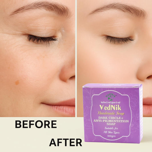 VedNik Dark Circle & Anti-Pigmentation Soap